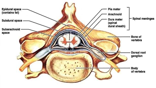 Embolism Of Fibrocartilage