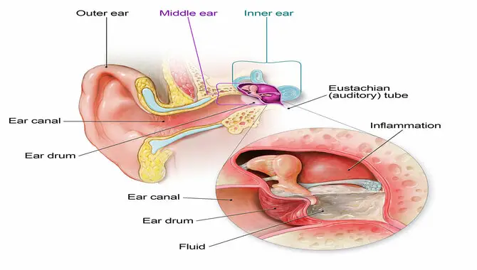 Infection In-Ear