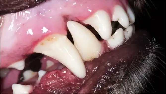 Teeth And Gum Health